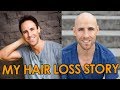 My Hair Loss Story | Going Bald Early Advice