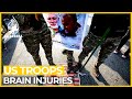 Analysis: 50 US troops face brain injuries after Iran strikes