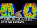 ‘Remarkable’ drug reduces Alzheimer’s decline, study shows