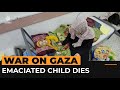 Emaciated child dies from lack of food and medicine in Gaza | Al Jazeera Newsfeed