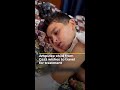 Amputee child from Gaza wishes to travel for treatment | AJ #shorts